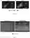 Fig. 12 - NET STABILIZATION AS A THERAPY FOR SEPSIS
