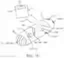 Fig. 03 - THERAPEUTIC AGENT PREPARATIONS FOR DELIVERY INTO A LUMEN OF THE INTESTINAL TRACT USING A SWALLOWABLE DRUG DELIVERY DEVICE
