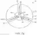 Fig. 11 - THERAPEUTIC AGENT PREPARATIONS FOR DELIVERY INTO A LUMEN OF THE INTESTINAL TRACT USING A SWALLOWABLE DRUG DELIVERY DEVICE