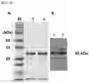 Fig. 03 - Method of treating pathogenic bacterial infectious diseases
