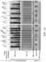 Fig. 12 - Method for preventing or treating metabolic disorder
