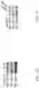 Fig. 31 - Method for preventing or treating metabolic disorder