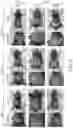 Fig. 70 - Method for preventing or treating metabolic disorder