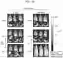 Fig. 05 - CYTOTOXIC T LYMPHOCYTES SPECIFIC FOR MUTATED FORMS OF EPIDERMAL GROWTH FACTOR RECEPTOR FOR USE IN TREATING CANCER
