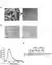 Fig. 02 - DELIVERY OF BACTERIA-DERIVED OUTER MEMBRANE VESICLES