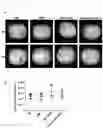 Fig. 14 - DELIVERY OF BACTERIA-DERIVED OUTER MEMBRANE VESICLES