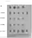 Fig. 15 - DELIVERY OF BACTERIA-DERIVED OUTER MEMBRANE VESICLES
