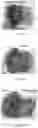 Fig. 03 - Monovalent vaccine formulation and a method for preparation thereof