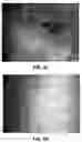 Fig. 07 - METHODS AND COMPOSITIONS FOR TREATING CHRONIC EFFECTS OF RADIATION AND CHEMICAL EXPOSURE