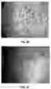 Fig. 08 - METHODS AND COMPOSITIONS FOR TREATING CHRONIC EFFECTS OF RADIATION AND CHEMICAL EXPOSURE