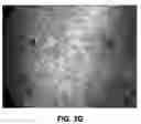 Fig. 09 - METHODS AND COMPOSITIONS FOR TREATING CHRONIC EFFECTS OF RADIATION AND CHEMICAL EXPOSURE
