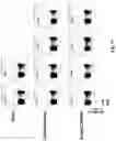 Fig. 16 - Novel Complex Comprising A Cell Penetrating Peptide, A Cargo And A TLR Peptide Agonist For Treatment Of Glioblastoma