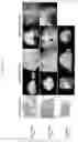 Fig. 11 - PEPTIDE AND USE THEREOF