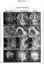 Fig. 17 - PEPTIDE AND USE THEREOF