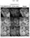 Fig. 21 - PEPTIDE AND USE THEREOF