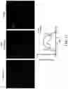 Fig. 15 - BIOMIMETIC ANISOTROPIC POLYMERIC PARTICLES WITH NATURALLY DERIVED CELL MEMBRANES FOR ENHANCED DRUG DELIVERY