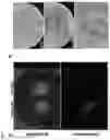 Fig. 21 - DELIVERY OF MACROMOLECULES INTO THE CENTRAL NERVOUS SYSTEM VIA THE BLOODSTREAM