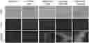 Fig. 01 - Doxorubicin Containing Nanoplexes and Uses Thereof