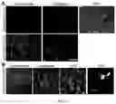 Fig. 06 - IMPROVED THERAPEUTIC METHOD FOR RARE OCULAR DISEASES BY GENE REPLACEMENT