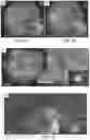 Fig. 02 - ENHANCED HUMAN OPSIN PROMOTER FOR ROD SPECIFIC EXPRESSION