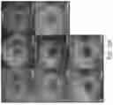 Fig. 19 - ENHANCED HUMAN OPSIN PROMOTER FOR ROD SPECIFIC EXPRESSION