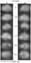 Fig. 25 - ENHANCED HUMAN OPSIN PROMOTER FOR ROD SPECIFIC EXPRESSION