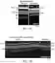 Fig. 30 - ENHANCED HUMAN OPSIN PROMOTER FOR ROD SPECIFIC EXPRESSION