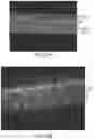 Fig. 35 - ENHANCED HUMAN OPSIN PROMOTER FOR ROD SPECIFIC EXPRESSION