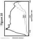 Fig. 11 - DYE ENHANCED VISUALIZATION OF CATARACT SURGERY