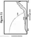 Fig. 12 - DYE ENHANCED VISUALIZATION OF CATARACT SURGERY