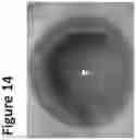 Fig. 15 - DYE ENHANCED VISUALIZATION OF CATARACT SURGERY