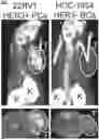 Fig. 01 - HER3 peptides for imaging and radiotherapy