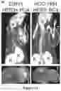 Fig. 05 - HER3 peptides for imaging and radiotherapy