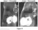 Fig. 09 - HER3 peptides for imaging and radiotherapy