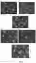 Fig. 09 - COMPOUNDS AND METHODS FOR THE DETECTION OF TRPV-6 CANCERS AND DRUG DELIVERY