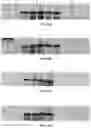 Fig. 13 - COMPOUNDS AND METHODS FOR THE DETECTION OF TRPV-6 CANCERS AND DRUG DELIVERY