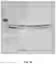 Fig. 14 - COMPOUNDS AND METHODS FOR THE DETECTION OF TRPV-6 CANCERS AND DRUG DELIVERY