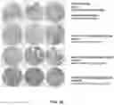 Fig. 17 - COMPOUNDS AND METHODS FOR THE DETECTION OF TRPV-6 CANCERS AND DRUG DELIVERY
