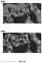 Fig. 18 - COMPOUNDS AND METHODS FOR THE DETECTION OF TRPV-6 CANCERS AND DRUG DELIVERY