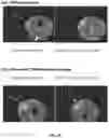 Fig. 21 - COMPOUNDS AND METHODS FOR THE DETECTION OF TRPV-6 CANCERS AND DRUG DELIVERY