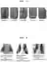 Fig. 06 - Method for preparing absorbable haemostatic composition for body and haemostatic composition prepared thereby
