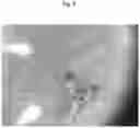 Fig. 07 - SCAR REDUCING WOUND CLOSURE MATERIALS
