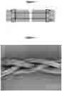 Fig. 02 - TISSUE REPAIR SCAFFOLD AND DEVICE