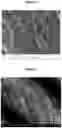 Fig. 04 - TISSUE REPAIR SCAFFOLD AND DEVICE