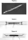 Fig. 06 - TISSUE REPAIR SCAFFOLD AND DEVICE