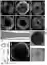 Fig. 14 - Tissue equivalent tubular scaffold structure, and methods of production thereof