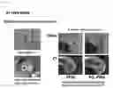 Fig. 03 - IMPLANT MATERIAL CONTAINING SURFACE-TREATED AROMATIC POLYETHER KETONE AND MANUFACTURING METHOD THEREFOR