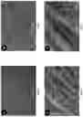 Fig. 11 - Biopolymer scaffold implants and methods for their production