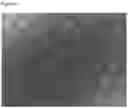 Fig. 03 - POROUS POLYMER SCAFFOLD AND METHODS THEREOF