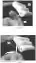 Fig. 48 - SELF-CONTAINED AUTO-INJECTOR